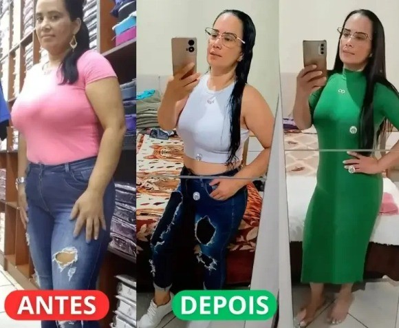 Antes e Depois Fernanda